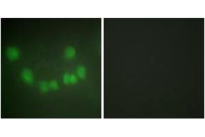 Immunofluorescence analysis of HuvEc cells, using CDC2 Antibody. (CDK1 Antikörper  (AA 101-150))