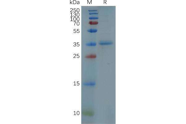 CXCR5 Protein (AA 1-53) (Fc Tag)