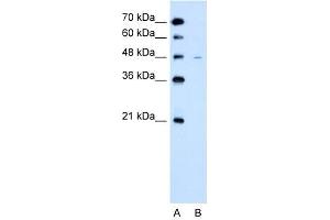 WB Suggested Anti-SLC43A3  Antibody Titration: 2. (SLC43A3 Antikörper  (N-Term))