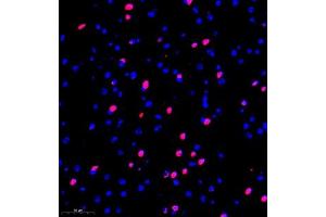 Immunofluorescence of paraffin embedded mouse brain using kb12 (ABIN7075406) at dilution of 1:700 (300x lens) (p130 Antikörper)