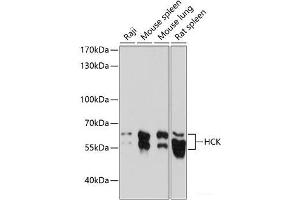 Western blot analysis of extracts of various cell lines using HCK Polyclonal Antibody at dilution of 1:1000. (HCK Antikörper)