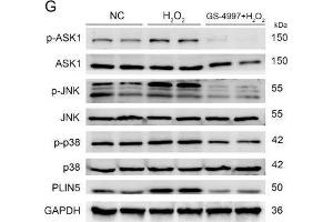 The expression of PLIN5 was regulated by the JNK-p38-ATF pathway. (MAPK14 Antikörper  (C-Term))