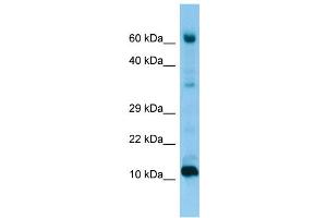 WB Suggested Anti-FABP9 Antibody Titration: 1. (FABP9 Antikörper  (Middle Region))