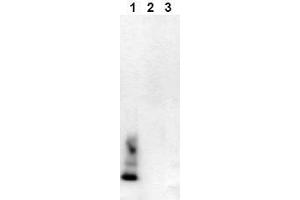 Western Blotting (WB) image for anti-Amyloid beta (Abeta) (AA 1-40), (C-Term), (N-Term) antibody (Biotin) (ABIN126717) (beta Amyloid Antikörper  (C-Term, N-Term) (Biotin))