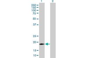 Western Blot analysis of IFNA16 expression in transfected 293T cell line by IFNA16 MaxPab polyclonal antibody. (IFNA16 Antikörper  (AA 1-189))