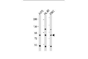 Western Blotting (WB) image for anti-ATP-Binding Cassette, Sub-Family B (MDR/TAP), Member 5 (ABCB5) (AA 1-30), (N-Term) antibody (ABIN390068)