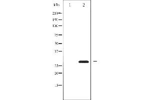 Western blot analysis of BCL-2 phosphorylation expression in nocodazole treated HeLa whole cell lysates,The lane on the left is treated with the antigen-specific peptide. (Bcl-2 Antikörper  (pSer87))
