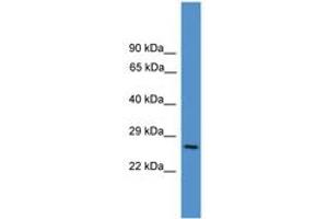 Image no. 1 for anti-CD8a Molecule (CD8A) (AA 91-140) antibody (ABIN6745375) (CD8 alpha Antikörper  (AA 91-140))