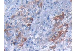 IHC-P analysis of Rat Adrenal gland Tissue, with DAB staining. (CARTPT Antikörper  (AA 28-129))