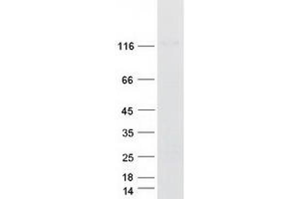 CARD10 Protein (Myc-DYKDDDDK Tag)