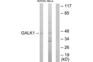 Western Blotting (WB) image for anti-Galactokinase 1 (GALK1) (N-Term) antibody (ABIN1849417) (GALK1 Antikörper  (N-Term))