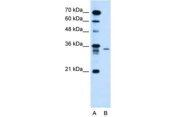 LY6G6F Antikörper  (N-Term)