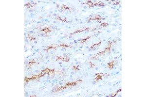 Immunohistochemistry of paraffin-embedded mouse kidney using CD138/Syndecan-1 Rabbit mAb (ABIN1683195, ABIN3018651, ABIN3018652 and ABIN7101639) at dilution of 1:100 (40x lens). (Syndecan 1 Antikörper)