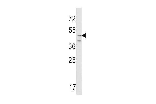 CRHR2 Antikörper  (N-Term)