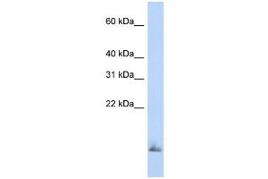WB Suggested Anti-SCGB1A1 Antibody Titration:  0. (SCGB1A1 Antikörper  (Middle Region))