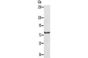 Western Blotting (WB) image for anti-Myxovirus Resistance Protein 1 (MX1) antibody (ABIN2430284) (MX1 Antikörper)