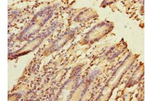 Immunohistochemistry of paraffin-embedded human duodenal tissue using ABIN7152685 at dilution of 1:100 (FRMD6 Antikörper  (AA 413-622))