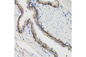 Immunohistochemistry of paraffin-embedded human prostate using ATP1A1 antibody (ABIN1871152) at dilution of 1:100 (40x lens). (ATP1A1 Antikörper)