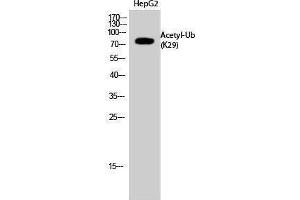 Western Blotting (WB) image for anti-Ubiquitin (Ubiquitin) (acLys29) antibody (ABIN3181497) (Ubiquitin Antikörper  (acLys29))