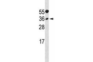 MYF5 antibody western blot analysis in A549 lysate. (MYF5 Antikörper  (AA 7-36))