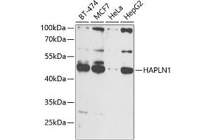 Western blot analysis of extracts of various cell lines, using H antibody (ABIN6129787, ABIN6141601, ABIN6141603 and ABIN6216048) at 1:1000 dilution. (HAPLN1 Antikörper  (AA 165-354))