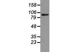 Western blot analysis of 35 µg of cell extracts from human colon adenocarcinoma (HT29) cells using anti-CTNNB1 antibody. (CTNNB1 Antikörper  (AA 531-781))