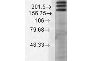 SHANK1 Western Blot. (SHANK1 Antikörper  (Internal Region))