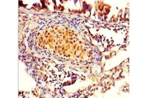 Immunohistochemistry of paraffin-embedded human lung tissue using ABIN7165430 at dilution of 1:100 (FAM161A Antikörper  (AA 1-300))