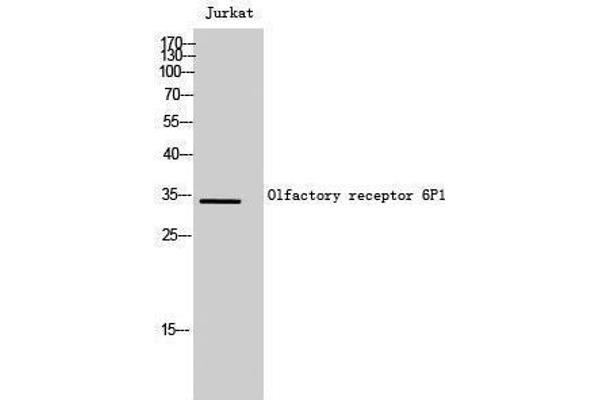 OR6P1 Antikörper  (Internal Region)