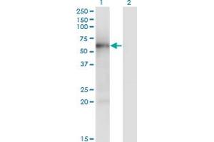 Western Blot analysis of MKNK1 expression in transfected 293T cell line by MKNK1 monoclonal antibody (M04), clone 5E12. (MKNK1 Antikörper  (AA 1-465))