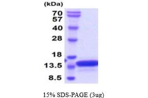 VAMP2 Protein (AA 1-94) (His tag)