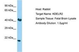 Image no. 1 for anti-KDEL (Lys-Asp-Glu-Leu) Endoplasmic Reticulum Protein Retention Receptor 2 (KDELR2) (C-Term) antibody (ABIN6750205) (KDELR2 Antikörper  (C-Term))