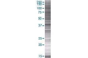 HAPLN3 transfected lysate. (HAPLN3 293T Cell Transient Overexpression Lysate(Denatured))