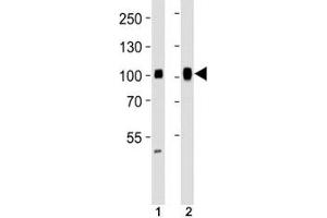 Western blot analysis of lysate from (1) HeLa and (2) Ramos cell line using SP1 antibody at 1:1000. (SP1 Antikörper)