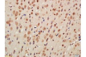 Formalin-fixed and paraffin embedded mouse brain labeled with Rabbit Anti-Histone H3 (Di Methyl K9) Polyclonal Antibody, Unconjugated  at 1:200 followed by conjugation to the secondary antibody and DAB staining (Histone 3 Antikörper  (H3K9me))