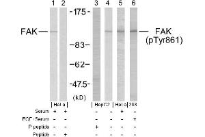 Image no. 1 for anti-PTK2 Protein tyrosine Kinase 2 (PTK2) (pTyr861) antibody (ABIN196719) (FAK Antikörper  (pTyr861))