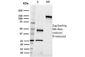 SDS-PAGE Analysis Purified CD22 Mouse Monoclonal Antibody (RFB4). (CD22 Antikörper)