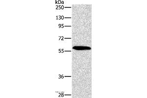 Western blot analysis of A172 cell, using PAK2 Polyclonal Antibody at dilution of 1:400 (PAK2 Antikörper)