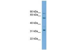 Image no. 1 for anti-phosphatidylserine Synthase 2 (PTDSS2) (AA 381-430) antibody (ABIN6745553) (PTDSS2 Antikörper  (AA 381-430))