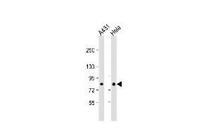 All lanes : Anti- EIF4B Antibody at 1:1000 dilution Lane 1: A431 whole cell lysate Lane 2: Hela whole cell lysate Lysates/proteins at 20 μg per lane. (EIF4B Antikörper)