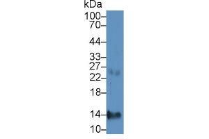 Detection of CXCL7 in Human Liver lysate using Monoclonal Antibody to Chemokine (C-X-C motif) ligand 7 ( CXCL7) (CXCL7 Antikörper  (AA 59-128))