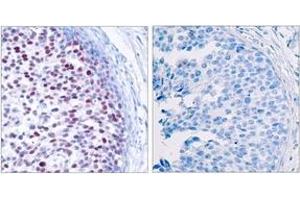 Immunohistochemistry (IHC) image for anti-Jun Proto-Oncogene (JUN) (pThr239) antibody (ABIN2888454) (C-JUN Antikörper  (pThr239))