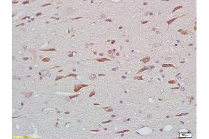 Formalin-fixed and paraffin embedded rat brain tissue labeled with Anti-phospho-Tau protein(Thr205) Polyclonal Antibody, Unconjugated (ABIN801813) at 1:200 followed by conjugation to the secondary antibody (tau Antikörper  (pThr212))