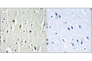Immunohistochemistry (IHC) image for anti-C-Src tyrosine Kinase (CSK) (AA 330-379) antibody (ABIN2888621) (CSK Antikörper  (AA 330-379))