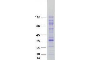 AARS Protein (Myc-DYKDDDDK Tag)