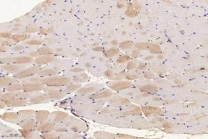 Immunohistochemistry analysis of paraffin-embedded mouse muscle using,SLC8A3 (ABIN7075684) at dilution of 1: 1600 (SLC8A3 Antikörper)