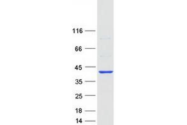 ARPC1B Protein (Myc-DYKDDDDK Tag)