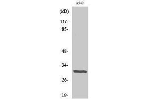 Western Blotting (WB) image for anti-Adiponectin (ADIPOQ) (N-Term) antibody (ABIN3172737) (ADIPOQ Antikörper  (N-Term))