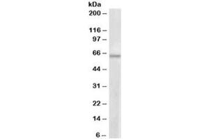 Western blot testing of MCF7 lysate with PRMT3 antibody at 1ug/ml. (PRMT3 Antikörper)