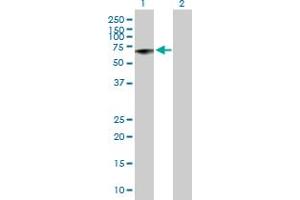 Western Blot analysis of MMP13 expression in transfected 293T cell line by MMP13 MaxPab polyclonal antibody. (MMP13 Antikörper  (AA 1-471))